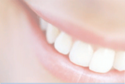 Blek dina tänder vackert vita